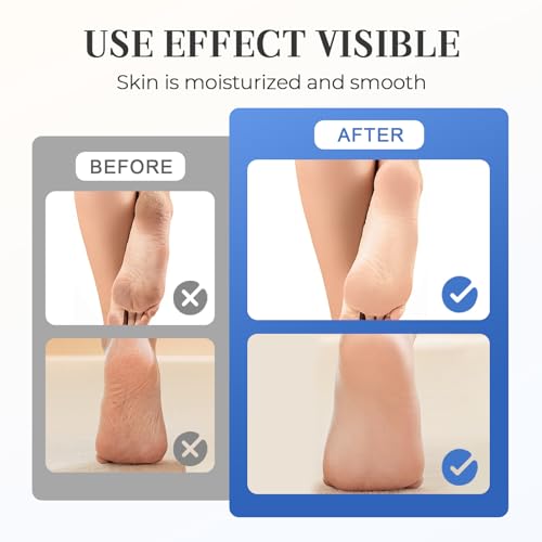 1.41oz Hydrating And Anti-Cracking Foot Cream 2025 New 60% Urea Moisturising And Relieves Cracking and Dryness Foot Cream for Women & Men Feet, Knee, Elbow, Hand (1)