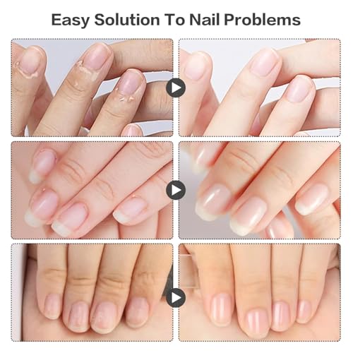 NailGrowthOil Care Kit - Brother Cosmetics Nail Growth Oil,Cuticle Oil and Cuticle Remover, Promotes Nail Growth and Strength