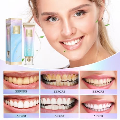2Pcs Niacinamide Whitening Toothpaste, Nicotinamide Dazzle White Toothpaste, Fresh Breath Niacinamide Whitening Toothpaste,Remove Tooth Stains