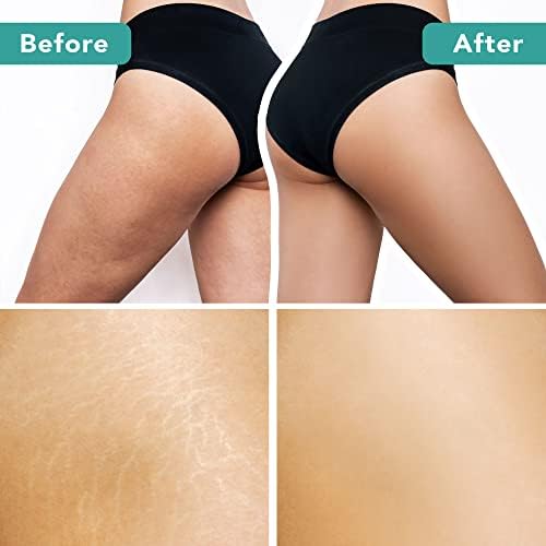 Dry Brushing Body Brush for Lymphatic Drainage & Cellulite - Natural Brustles for Wet and Dry Brushing, Body Exfoliating Brush with Massage Nodes for Soft & Smooth Skin