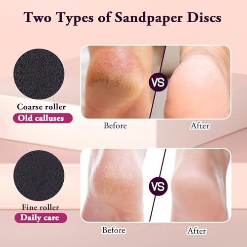 AFFLAT Electric Foot Callus Remover, Adjustable Speed (0-600Rpm), Adjustable Speed Foot Scrubber with 60 Pcs Sandpaper Discs, Electric Callus Remover for Feet,Pedicure Tool for Men and Women,Pink