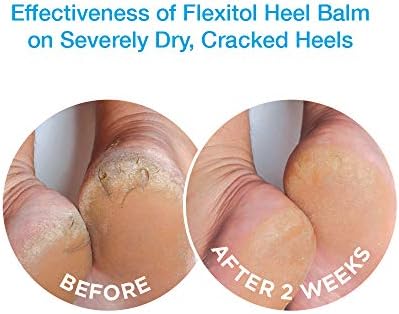 Flexitol Heel Balm 4 Oz Tube (Pack of 2), Rich Moisturizing & Exfoliating Foot Cream. Fast Relief of Rough, Dry & Cracked Skin on Heels/Feet. For Daily Use and Pedicures. Diabetic Safe and Effective