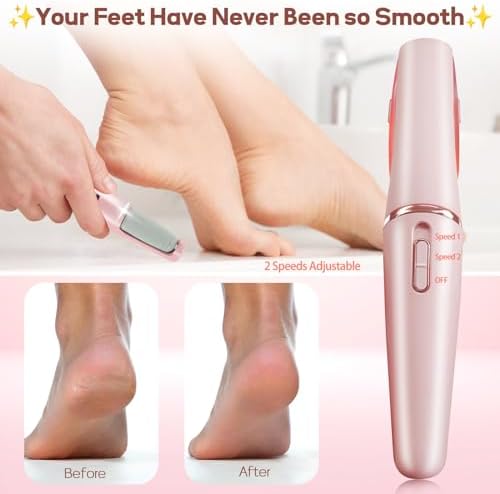 Callus Remover for Feet, ZABOUL Electric Foot Callus Remover Rechargeable Pedicure Tools Smooth Pedicure Wand Electronic Foot File, Feet Care for Removes Dry Hard & Dead Skin Ideal Gift
