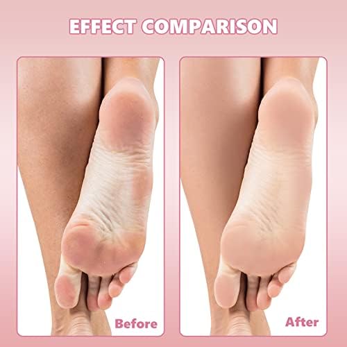 Flutesan 120 Pcs Stainless Steel Foot File Replacement Pads 120 Grit 180 Grit Pedicure Refill Pads Coarse Fine Pedicure File Refills Foot Rasp with Removable Glue for Callus Dead Skin, Black