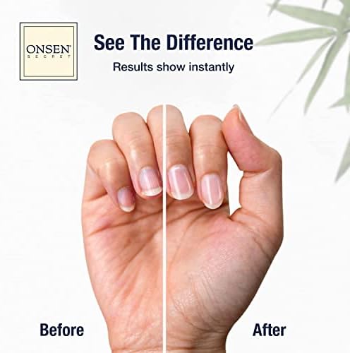 Onsen Secret Japanese Nail Reboot Cuticle Oil Kit | Buffer and Shine Kit w/ Professional File, 3-Way Buffer Block & Free Replacement Pads | Strengthening Combo for Healthy Nails, 1pk