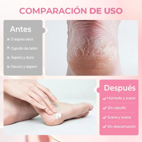 Hydrating and Anti-Cracking Foot Cream, 2025 Upgraded Smooth Steps Foot Therapy Balm, Foot Cream for Dry Cracked Heels and Feet Women Men (Peach, 40g)