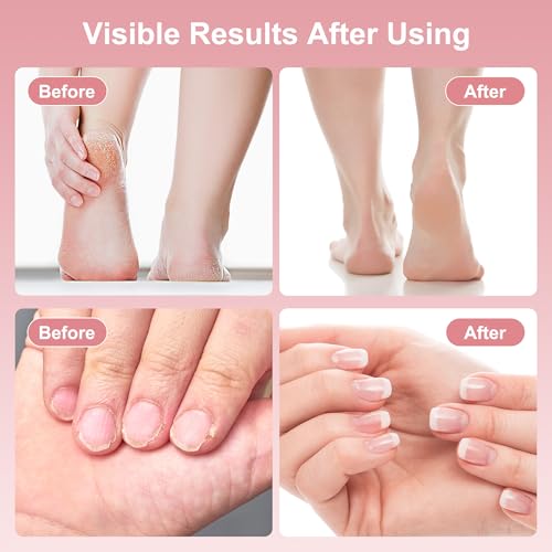 Electric Foot Callus Remover, 2 in 1 Rechargeable Foot File for Feet & Nails, 9 Speed Controller Callus Remover with Replaceable Sandpaper, Cordless Pedicure Tools for Dead Skin and Calluses (Pink)