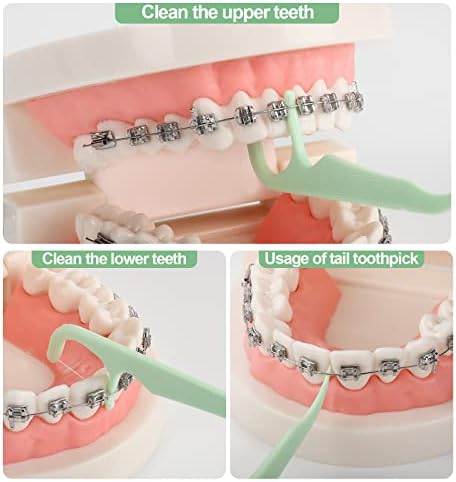 500 Count Orthodontic Flossers for Braces with Floss Dispenser, Braces Flossers for Adults & Kids, Floss Picks for Braces Fits Under Arch Wire, No Break & No Shred Floss, 100 Count Bag (Pack of 5)