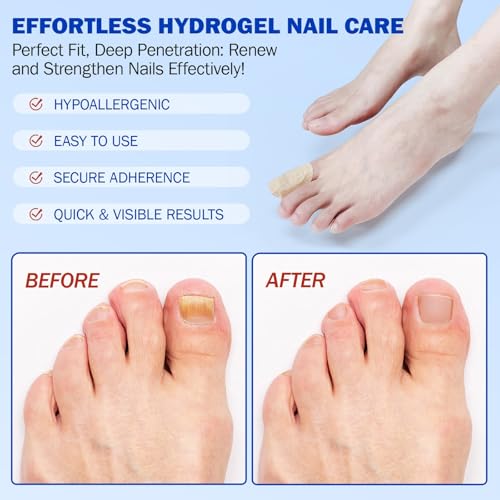 2Pack Fungal Nail Patches, Nail Fungus Patches for Toenail, Fingernail Fungus Treatment,Overnight Toe Nail Treatments for Damaged Nails Ingrown Toenail Foot Nails Repair and Care
