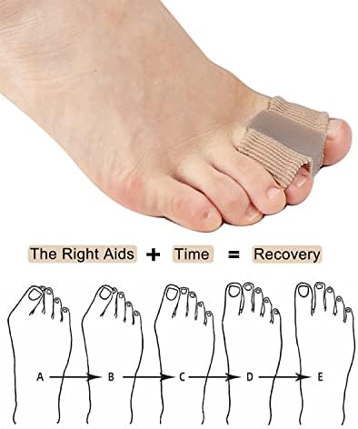 Bunion Toe Separators for Overlapping Toes Women Men, Gel Toe Spacers Bunion Corrector with 2 Loops for feet (4PC)
