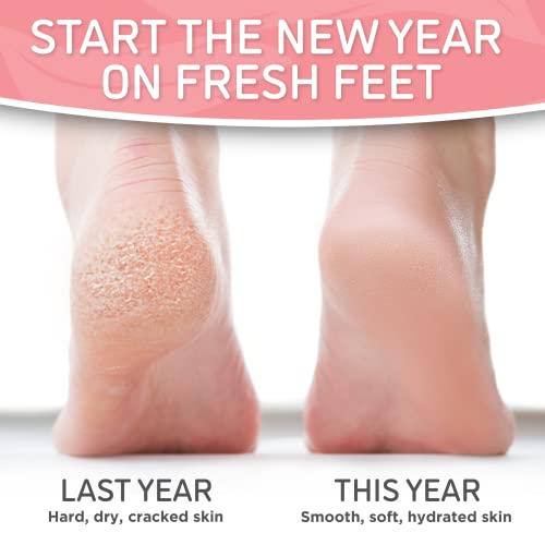 Dermora Soft Touch Foot Peel Mask - Pack of 2 Feet Peeling Masks for Dry, Cracked Heels & Calluses - Exfoliating Foot Mask Peel for Baby Soft Skin (Original)