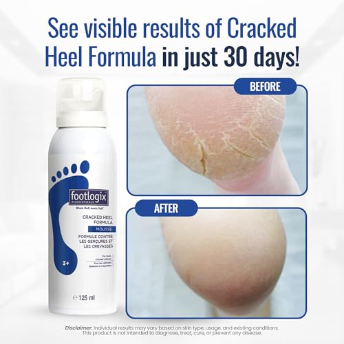 FOOTLOGIX Cracked Heel Formula, White 4.23 Ounce