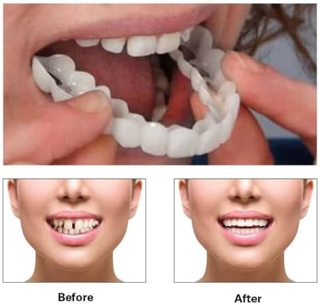 2 Pairs, Temporarily Adjustable for Men and Women, Regain Confidence