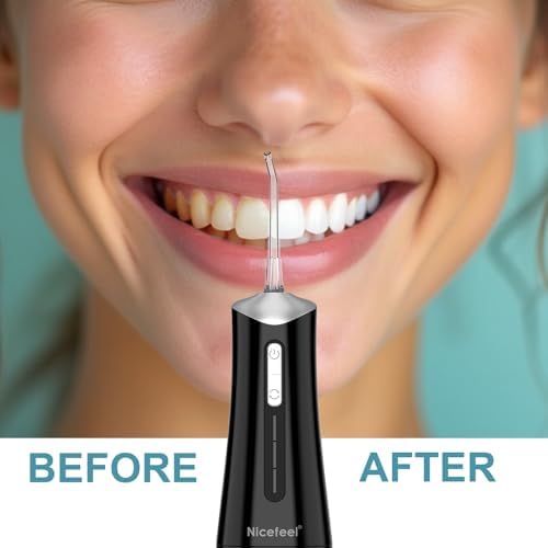 Nicefeel Water Dental Flosser Pick for Teeth 3 Modes Cordless Portable Water Teeth Cleaner Ipx7 Waterproof Oral Irrigator 300ml Tank Water Teeth Cleaner Rechargeable Flossing (Black, 4 Modes)