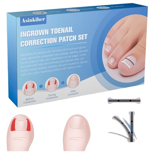 Titanium Alloy Ingrown Toenail Treatment, Ingrown Toenail Removal Kit for Curved Nail Repair, Ingrown Nail Tool for Home Use