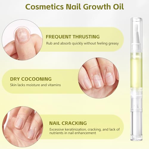 Nailz Nail 𝐆𝐫𝐨𝐰𝐭𝐡 Pen,Radiant Nail Growth GIL,Radiant Nail Growth Oil Pen,Cuticle Oil for Nails,Nail Strengthener, for Moisturize Strengthen Nail Care,Finger Edge Manicure Nourishing Pen(4PCS)