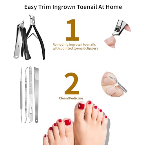 Ingrown Toenail Removal Kit, 6PCS Stainless Steel Toe Nail Kit, Straight Edge Oblique and Curved Slanted Nail Clippers Cutters for Ingrown Nails, Professional Pedicure Tool at Home