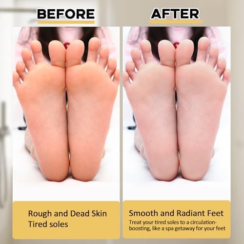 Extra Thicker & Larger Foot Scrubber Mat for Shower, Silicone Back Body Exfoliator Massager Cleaner Washer with Non Slip Suction Cup, Exfoliating Scrub Brush Pad for Women Men Elderly
