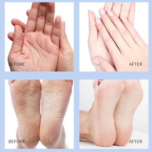 Crack Feet Prevention Stick, Foot Care Cream Cracked Feet, Moisturizing Foot Balm Stick, Softening and Nourishing Cream for For Dry Heels