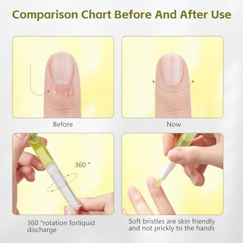 Nailz Nail 𝐆𝐫𝐨𝐰𝐭𝐡 Pen,Radiant Nail Growth GIL,Radiant Nail Growth Oil Pen,Cuticle Oil for Nails,Nail Strengthener, for Moisturize Strengthen Nail Care,Finger Edge Manicure Nourishing Pen(4PCS)