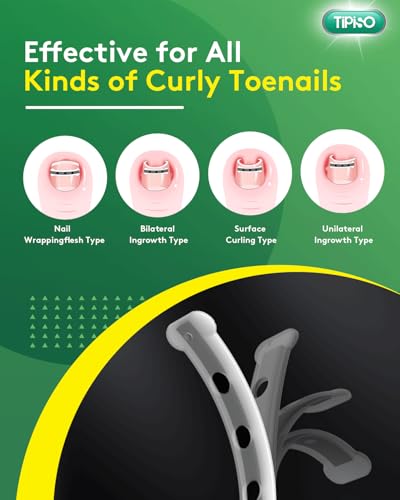 Ingrown Toenail Treatment Kit - Titanium Alloy Nail Corrector Tools, Quick Relief & Long-term Correction Patch for Ingrown Nails, Solution for Curved Toenail Repair & Removal (0.51/0.59/0.67/0.79in)