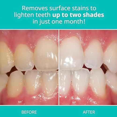 Opalescenc Teeth Whitening Toothpaste Travel Size 1 oz (2 Pack) - Fluoride Teeth Whitening Toothpaste, Cool Mint Flavor, Gluten-Free