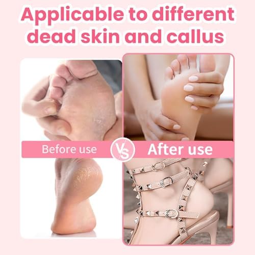 Dermave Electric Foot Callus Remover, 800RPM Electric Foot File Callus Remover for Feet with 60 pcs Sandpaper Discs, Stepless Speed Professional Foot Scrubber Pedicure Tools for Dead Skin and Calluses