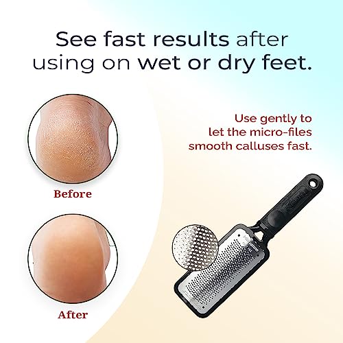 Microplane Colossal Foot File Scraper - The Original Stainless Steel Foot Rasp, Dead Skin/Callus Remover for Feet, Gentle Foot Scrubber, Pedicure Tools for Salon-Quality Foot Care, Black