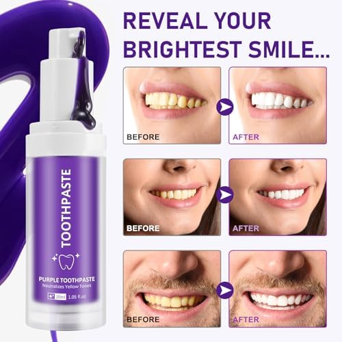 Purple Toothpaste, Teeth Whitening Colour Corrector Toothpaste for Teeth Whitening, Color Correcting Technology, Natural Removal Surface Stain