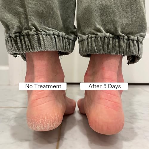 Cracked Heel Repair Foot Care Balm, Smooths & Fills Cracks & Rough Skin with Healing Shea & Mango Butters, Vegan, Cruelty Free, 1 oz