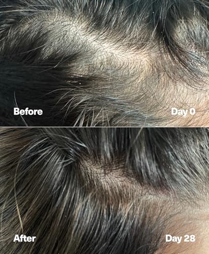 PowerCycle Exosome Scalp Serum – Exosomes for Hair Regrowth, NX35 Growth Serum, Hair Thickening Treatment for Women and Men, Lightweight Leave-In Formula, 60 mL