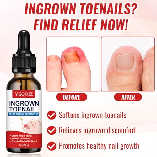 Ingrown Toenail Removal Kit, Ingrown Toenail Relief Tool Kit with Ingrown Toenail Corrector, Ingrown Toenail Drops, Corrector Patch, Toenail Clipper, Nail File Lifter Tools