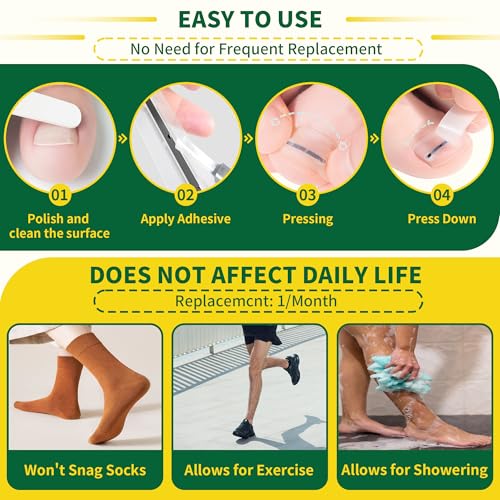 Titanium Alloy Ingrown Toenail Treatment & Removal Kit for Quick Relief, Ingrown Toenail Removal Kit， Professional Ingrown Toenail Corrector, Ingrown Toenail Tools for Quick Relief, 10 Pcs