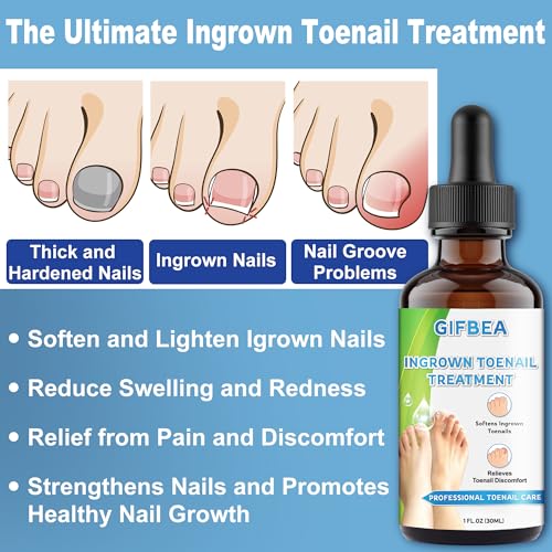 Ingrown Toenail Treatment w/Ingrown Toenail Drops Reliever & Softener,Double Sided Pedicure Nail Lifter Tool for Easy Trimming Care Thick Nail & Ingrown Toe Nail,Toenail Cleaner Kit for Men Women