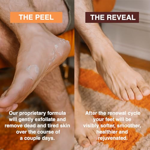 Foot Peel Mask with Eucalyptus and Lavender (2-Pack) | Remove and Exfoliate Dead Skin | Perfect for Men and Women | Removes and Repairs for Dry, Rough, Cracked Heels and Calluses