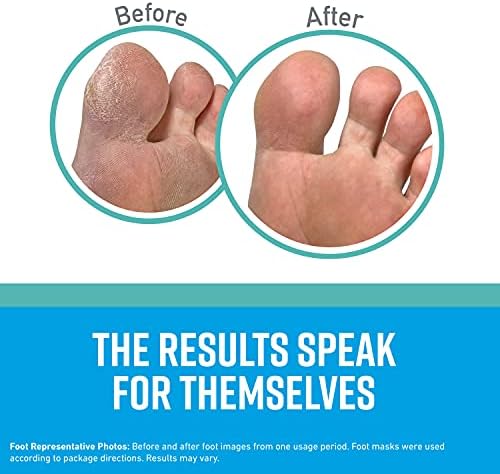 O'Keeffe's for Healthy Feet Intensive Moisturizing Foot Mask; Guaranteed Relief for Extremely Dry; Rough Feet; One Pair Single-Use Hydrating Foot Mask Socks; (Pack of 4)