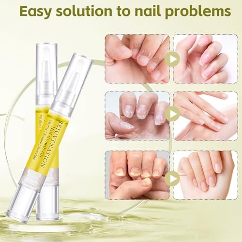 Rejuvenation Nail Growth Oil, Nail Oil for Growth and Strength Rejuvenation, Rejuvenation Nail Growth Serum for Nail Strengthener and Growth with Nails File (4PCS)