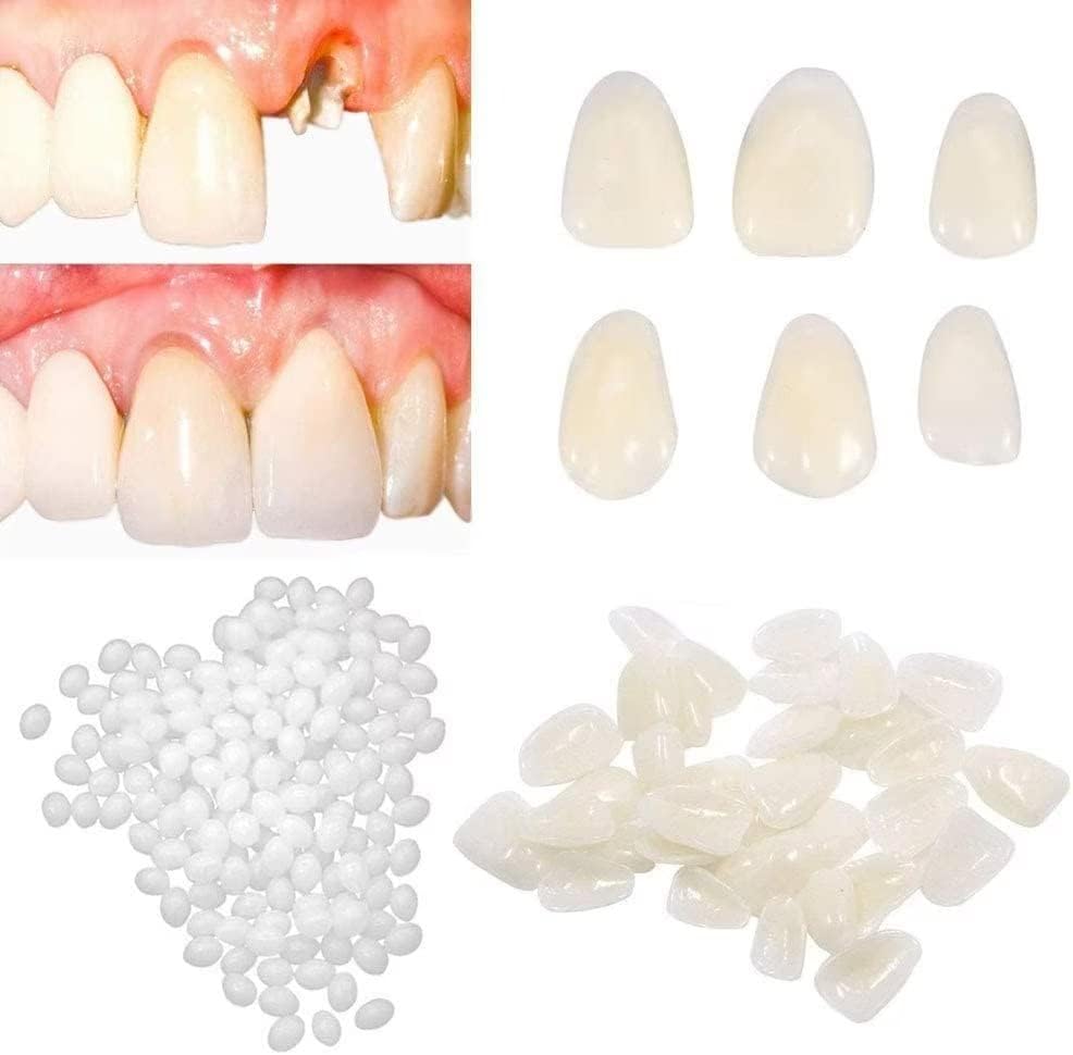 Fake Tooth Repair kits for Filling The Missing Broken Tooth and Gaps-Moldable and False Teeth Thermal Beads Replacement Kits