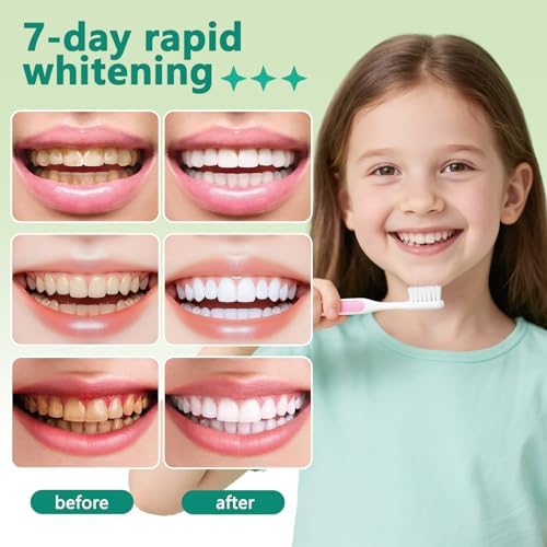 Hydroxyapatite Toothpaste, Helps Remineralize Teeth, Nano Hydroxyapatite Toothpaste, Repair Sensitive Teeth and Effectively Whiten Teeth, Fluoride-Free, Refreshing Mint Flavor 2Pcs