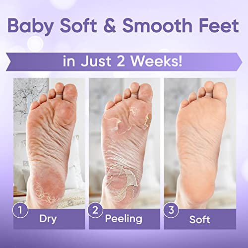 Foot Peel Mask - Foot Mask for Baby Soft Skin - Remove Dead Skin, Dry, Cracked Feet & Callus, Foot Spa, Made with Aloe Vera Extract for Women and Men (5 Pairs Lavender)