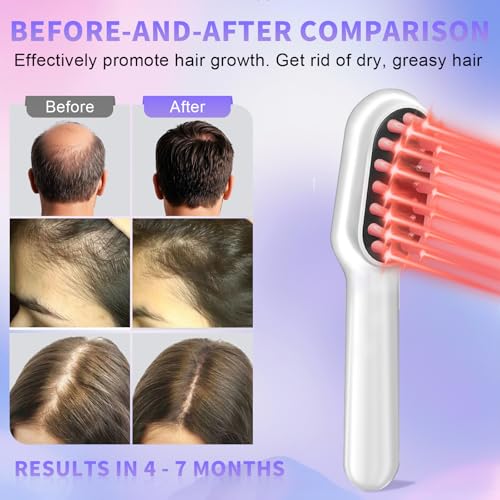 Laser Hair Growth Comb - Handheld Hair Growth Comb Device Promotes Hair Growth for Thicker, Healthier Hair