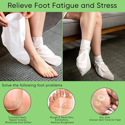 Aloe Vera Foot Peeling Mask, Baby Feet Exfoliating Peel for Dead Skin Removal& Moisturizing Care, Dry Cracked Heels Relief, Softening Rough Feet Spa Socks, 3 Pairs Pack(Unisex)