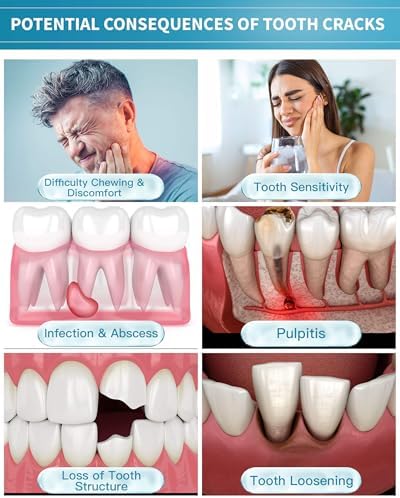 Healing Teeth Crack Toothpaste - Repairing Cracked Teeth Enamel, Remineralizing Toothpaste 100g