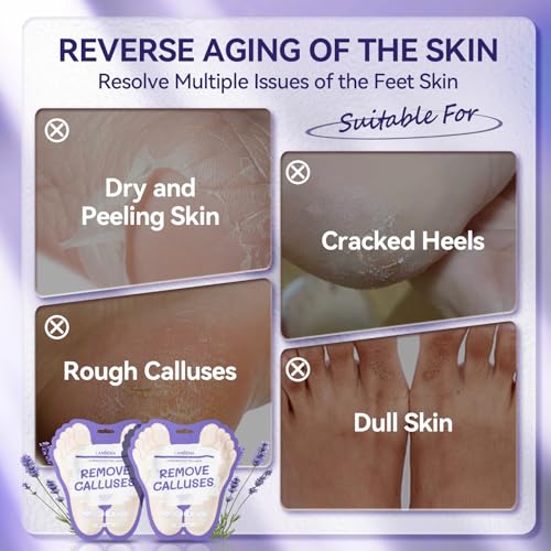 LANBENA Lavender Foot Peel Mask - Foot Peeling Mask for Removing Dry Dead Skin, Calluses & Repairing Rough Heels, for Baby Soft, Smooth Feet - (Lavender - 2 Pairs)