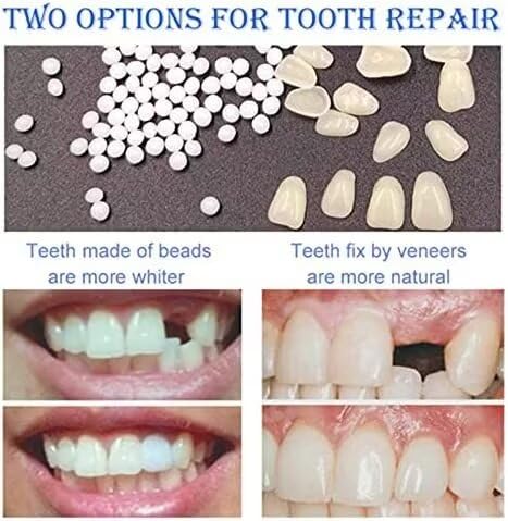 Fake Tooth Repair kits for Filling The Missing Broken Tooth and Gaps-Moldable and False Teeth Thermal Beads Replacement Kits