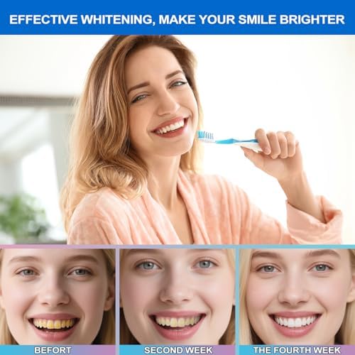 Advanced Niacinamide Whitening Toothpaste - Brightens Teeth Safely, Strengthens Enamel & Provides 24-Hour Fresh Breath Fluoride-Free Formula is Suitable for Sensitive Teeth