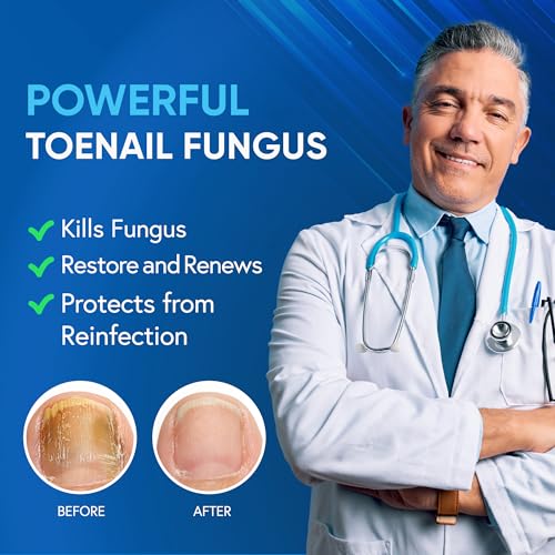 Toenail Fungus Treatment For Toenail & Finernails, 25% Undecylenic acid, Toe Nail Fungus Treatment Extra Strength, Tea Tree Oil for Tonail Fungus Treatment